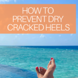 Tips to help with dry feet, cracked heels, and polished toes