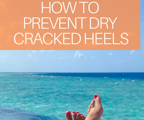 Tips to help with dry feet, cracked heels, and polished toes